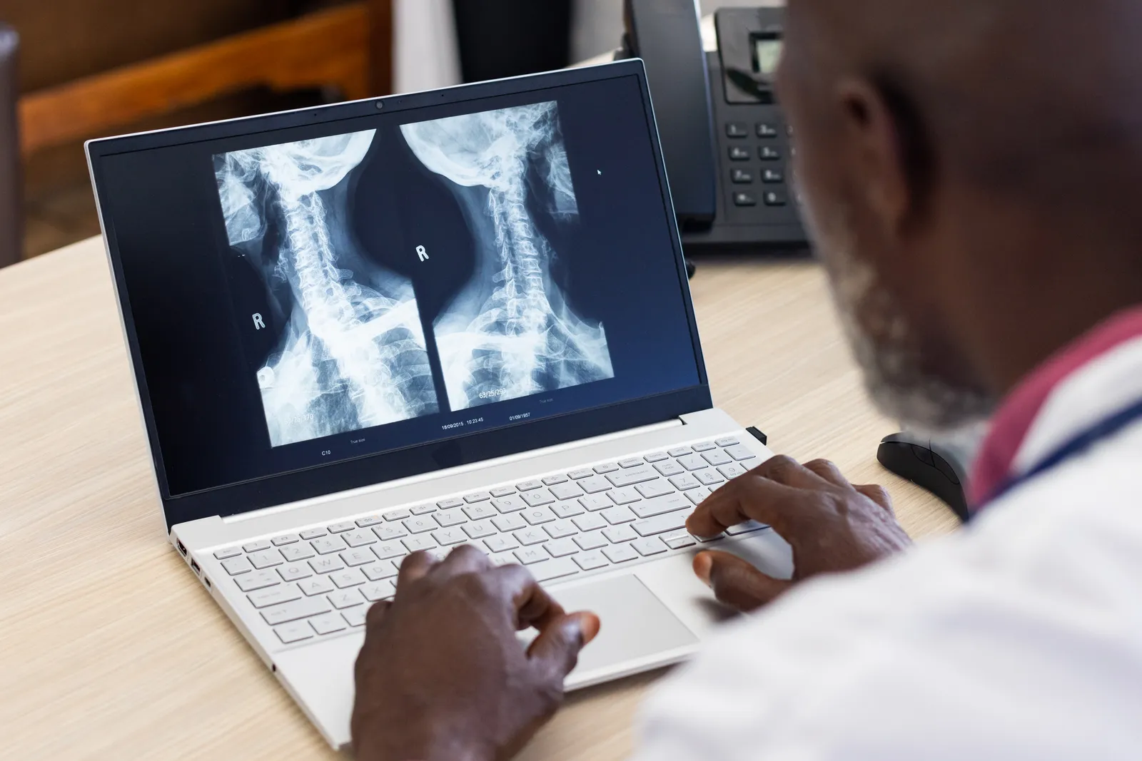 Physician reviewing cervical spine X-ray images on a laptop, comparing prior and new imaging